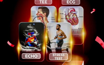 Dobutamin stress Echo & Ecg exercise stress test