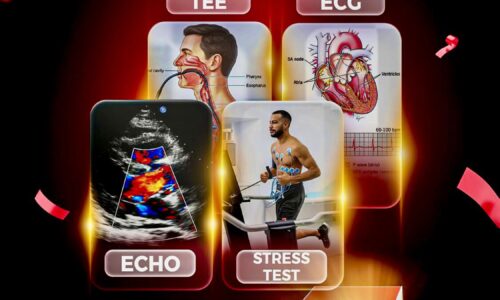 Dobutamin stress Echo & Ecg exercise stress test